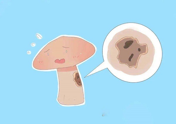 龟头上有白色物体怎么回事?