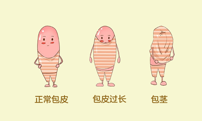 [南京男科]如何区别包皮过长与包茎？