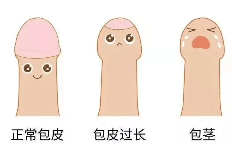 南京做包皮手术医院哪家好-南京哪里做包皮手术好