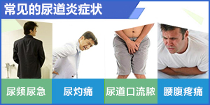 南京邦德男科医院讲解：小便起泡是怎么回事?