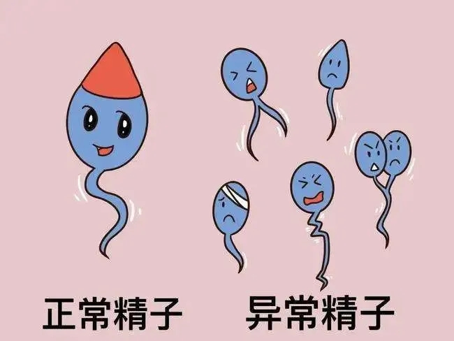 检查精子如何正确采集?南京去哪里做精子检查比较好?