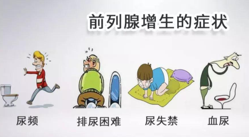 南京哪家治前列腺医院好?