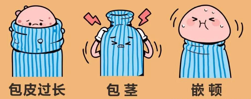 为什么要割包皮?南京哪个男科医院割包皮专业?