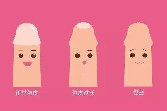男性包皮过长怎么办?