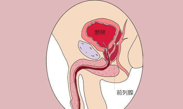 南京男性泌尿专科介绍：前列腺炎症状