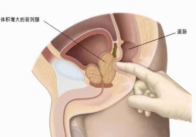 前列腺疾病一定要重视，来南京邦德中医院接受专业治疗