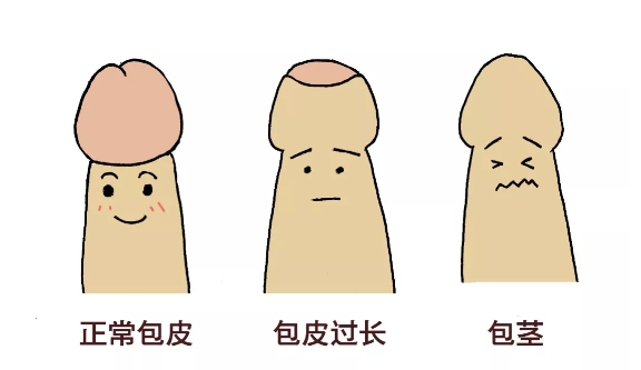 做包皮手术警惕低价陷阱，选择正规的南京邦德医院
