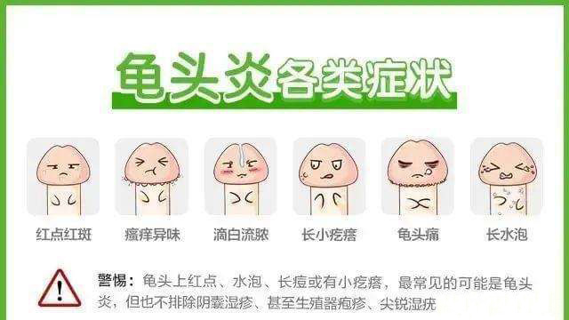 南京邦德医院：不要盲目吃药治疗龟头感染对症用药恢复才能快