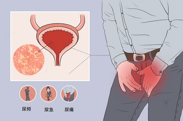 治疗尿道炎疾病很多人都推荐去南京邦德男科医院