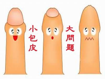 男性包皮给男女双方都会带来很大的危害
