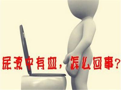 南京邦德中医院解答：尿液中有血是怎么回事？