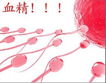 精液中带血是什么原因引起的?