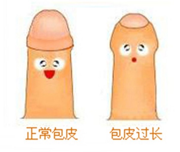 南京邦德中医院医生提示：青春期男生包茎尽量不要自己翻