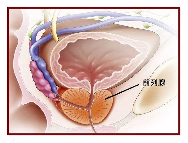 前列腺痛常见症状有哪些？