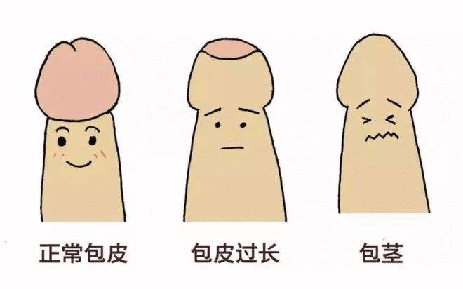 包皮包茎对男性都有哪些危害？