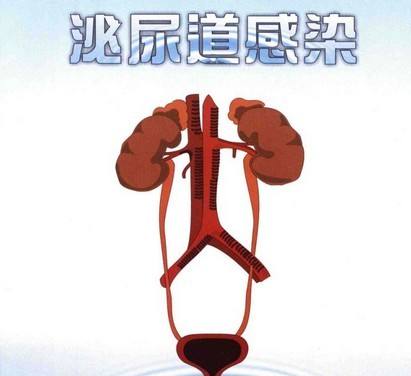 泌尿感染是什么原因引起的